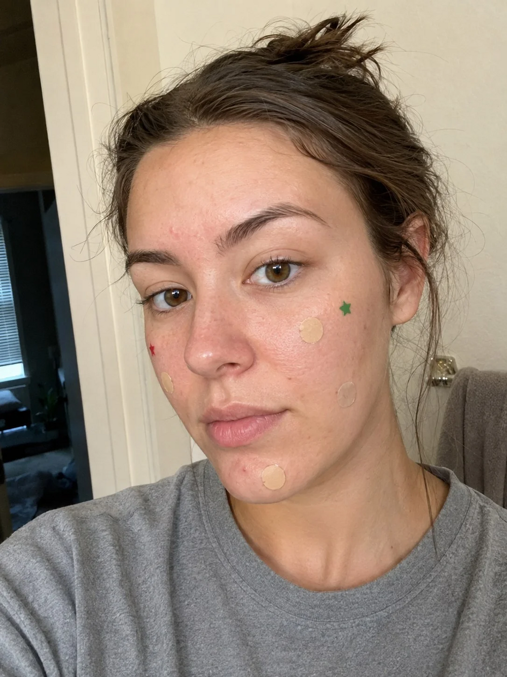 You don't want to see the pimple. So why see the patch?