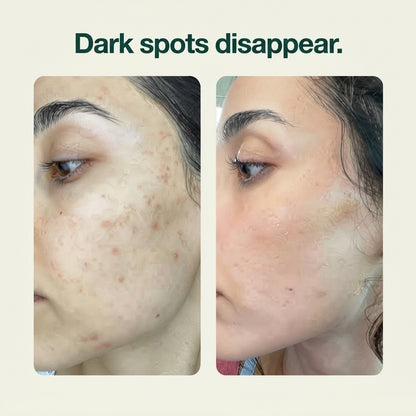 Ultra Thin Dark Spot Patch