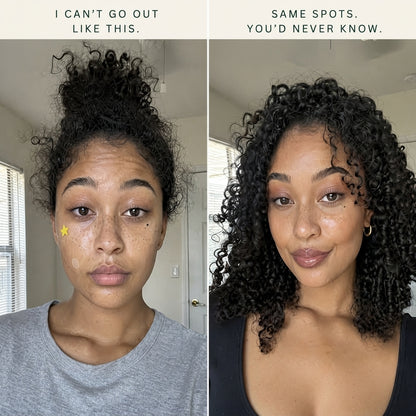 Ultra Thin Dark Spot Patch